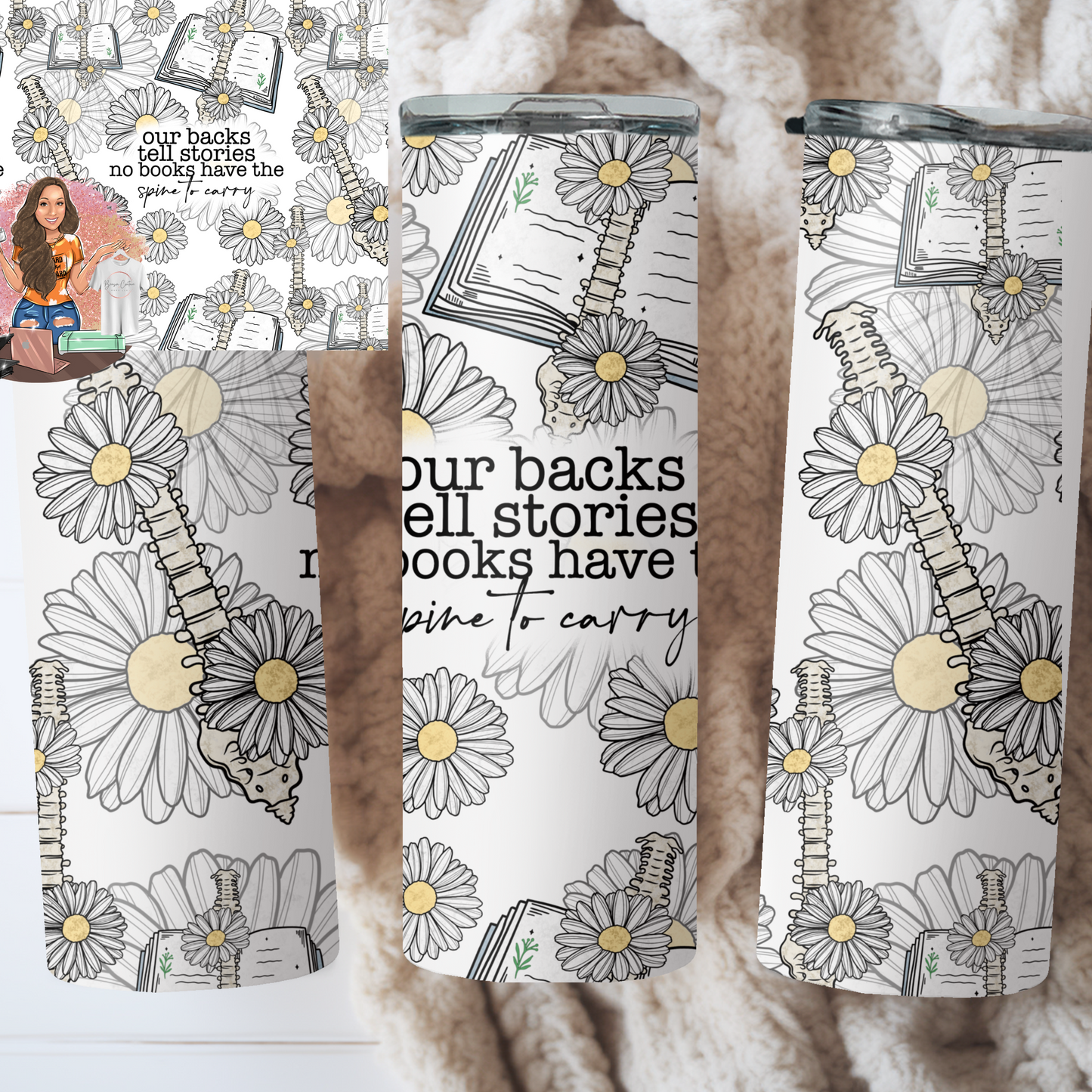 Our bBacks Tell The Stories No Books Have The Spine To Carry